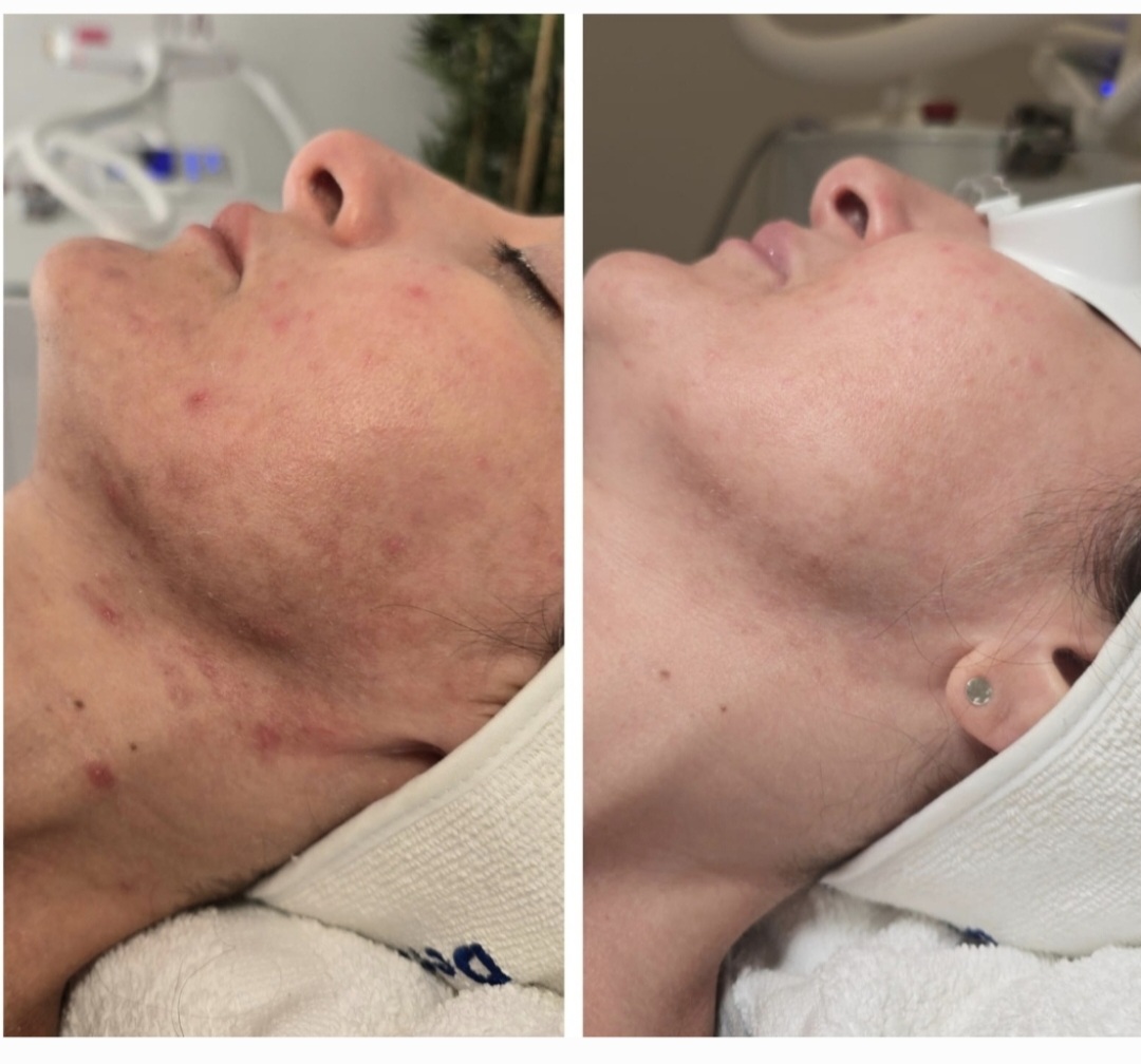 Pigmentation & dullness transformation